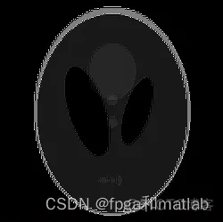 基于Radon滤波反投影算法的CT图像重建matlab仿真_matlab_15